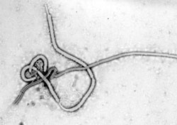 Obrázok vírusu Ebola (pdf, 7 kB)